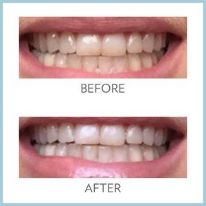 COPY - Nu Skin- AP 24® Whitening Fluoride Toothpaste